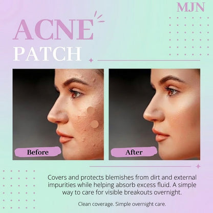 AuraShield™ Pimple Patch