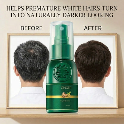 AuraRoot™ Ginger Hair Revival Spray 100ml